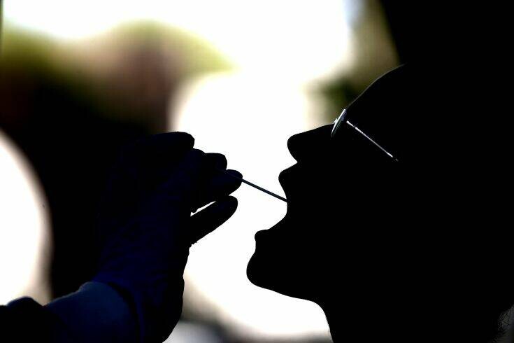 Κορονοϊός: Ένα νέο τεστ αίματος αυτο-αντισωμάτων μπορεί να προβλέψει την πιθανότητα σοβαρής λοίμωξης