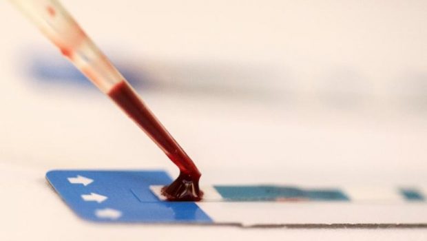 Κύπρος: Ανακαλύφθηκε νέο στέλεχος HIV – Μωσαϊκό τεσσάρων στελεχών του ιού HIV-1