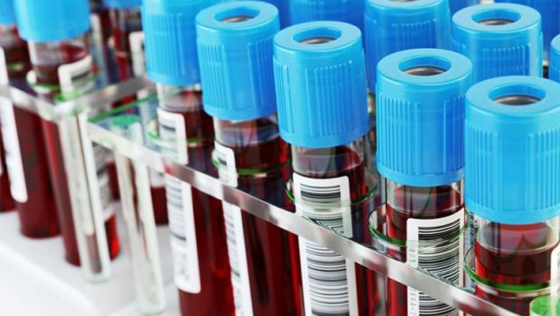 Κοροναϊός: Έρχεται το πρώτο τεστ αίματος που θα προβλέπει ποιος κινδυνεύει με long covid
