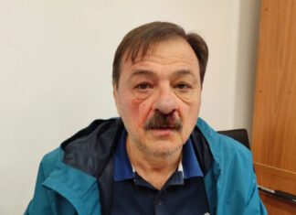 Επίθεση με γροθιές σε δημοτικό σύμβουλο από μασκοφόρο συνάδελφό του