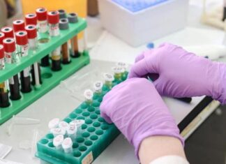 Ξεχειλίζει η οργή των εργαστηριακών γιατρών – Στη Λάρισα έχουν κλείσει τρία μικροβιολογικά εργαστήρια