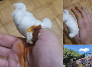 Θεσσαλός ηθοποιός θύμα άγριας επίθεσης με μαχαιριές στην Αθήνα – Σοκαριστική μαρτυρία