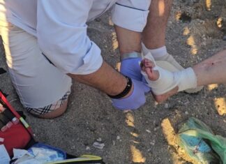 Σοκαριστικό: Θαλάσσια χελώνα επιτέθηκε σε λουόμενη σε παραλία – Την τραυμάτισε σοβαρά στο πόδι