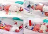 Γεννήθηκαν πανομοιότυπα τετράδυμα από φυσική σύλληψη – Eγκυμοσύνη που συμβαίνει μία φορά στα 15 εκατομμύρια