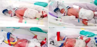 Γεννήθηκαν πανομοιότυπα τετράδυμα από φυσική σύλληψη – Eγκυμοσύνη που συμβαίνει μία φορά στα 15 εκατομμύρια