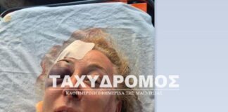 «Ετρεχαν, θα μπορούσε να πέθαινα!», λέει λουόμενη που τραυματίστηκε από σκάφος στη Σκιάθο