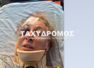 «Ετρεχαν, θα μπορούσε να πέθαινα!», λέει λουόμενη που τραυματίστηκε από σκάφος στη Σκιάθο